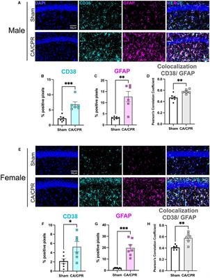 Astroglial CD38 impairs hippocampal synaptic plasticity after global cerebral ischemia